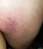Imgur
